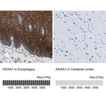 Annexin A1 Antibody in Immunohistochemistry (Paraffin) (IHC (P))