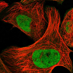 HDAC1 Polyclonal Antibody