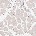 HDAC1 Antibody in Immunohistochemistry (Paraffin) (IHC (P))