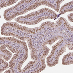 HDAC1 Antibody in Immunohistochemistry (Paraffin) (IHC (P))