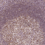 HDAC1 Antibody in Immunohistochemistry (Paraffin) (IHC (P))
