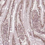 HDAC1 Antibody in Immunohistochemistry (Paraffin) (IHC (P))