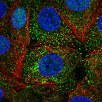 Estrogen Receptor alpha Polyclonal Antibody