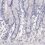 Estrogen Receptor alpha Antibody in Immunohistochemistry (Paraffin) (IHC (P))