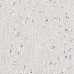 Estrogen Receptor alpha Antibody in Immunohistochemistry (Paraffin) (IHC (P))