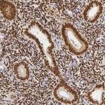 Estrogen Receptor alpha Antibody in Immunohistochemistry (Paraffin) (IHC (P))
