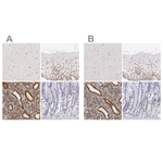 Estrogen Receptor alpha Antibody in Immunohistochemistry (Paraffin) (IHC (P))