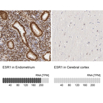 Estrogen Receptor alpha Antibody in Immunohistochemistry (Paraffin) (IHC (P))