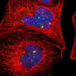alpha Actinin 4 Polyclonal Antibody