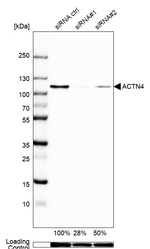 alpha Actinin 4 Antibody in Western Blot (WB)