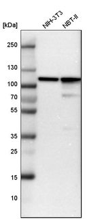 alpha Actinin 4 Antibody in Western Blot (WB)