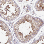 SKP2 Antibody in Immunohistochemistry (Paraffin) (IHC (P))