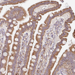 SKP2 Antibody in Immunohistochemistry (Paraffin) (IHC (P))