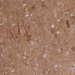 SKP2 Antibody in Immunohistochemistry (Paraffin) (IHC (P))