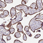 SKP2 Antibody in Immunohistochemistry (Paraffin) (IHC (P))