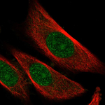 SKP2 Antibody in Immunocytochemistry (ICC/IF)