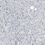 HDAC2 Antibody in Immunohistochemistry (Paraffin) (IHC (P))