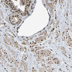 HDAC2 Antibody in Immunohistochemistry (Paraffin) (IHC (P))