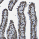 HDAC2 Antibody in Immunohistochemistry (Paraffin) (IHC (P))