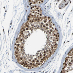 HDAC2 Antibody in Immunohistochemistry (Paraffin) (IHC (P))