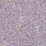 IDH1 Antibody in Immunohistochemistry (Paraffin) (IHC (P))