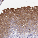 IDH1 Antibody in Immunohistochemistry (Paraffin) (IHC (P))