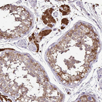 IDH1 Antibody in Immunohistochemistry (Paraffin) (IHC (P))