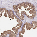 IDH1 Antibody in Immunohistochemistry (Paraffin) (IHC (P))