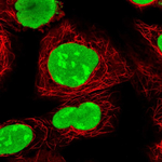 PARP1 Polyclonal Antibody