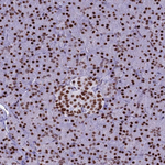 PARP1 Antibody in Immunohistochemistry (Paraffin) (IHC (P))