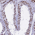 PARP1 Antibody in Immunohistochemistry (Paraffin) (IHC (P))