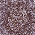 PARP1 Antibody in Immunohistochemistry (Paraffin) (IHC (P))