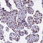 PARP1 Antibody in Immunohistochemistry (Paraffin) (IHC (P))