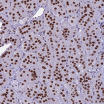 PARP1 Antibody in Immunohistochemistry (Paraffin) (IHC (P))