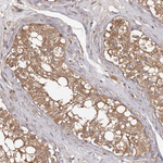 PKM2 Antibody in Immunohistochemistry (Paraffin) (IHC (P))