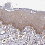 PKM2 Antibody in Immunohistochemistry (Paraffin) (IHC (P))