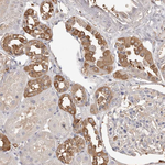 PKM2 Antibody in Immunohistochemistry (Paraffin) (IHC (P))