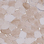 PKM2 Antibody in Immunohistochemistry (Paraffin) (IHC (P))
