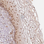 PSMD1 Antibody in Immunohistochemistry (Paraffin) (IHC (P))
