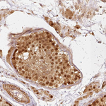 PSMD1 Antibody in Immunohistochemistry (Paraffin) (IHC (P))
