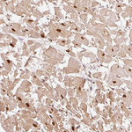 PSMD1 Antibody in Immunohistochemistry (Paraffin) (IHC (P))