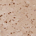 PSMD1 Antibody in Immunohistochemistry (Paraffin) (IHC (P))