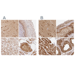 PSMD1 Antibody in Immunohistochemistry (Paraffin) (IHC (P))