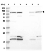 PSMD1 Antibody in Western Blot (WB)