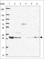 C20orf43 Antibody in Western Blot (WB)