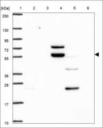 CYP27B1 Polyclonal Antibody