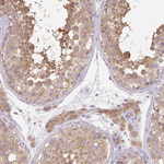 RAB11A Polyclonal Antibody