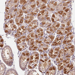 RAB11A Antibody in Immunohistochemistry (Paraffin) (IHC (P))