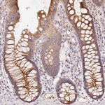 RAB11A Antibody in Immunohistochemistry (Paraffin) (IHC (P))