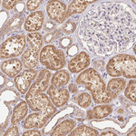 RAB11A Antibody in Immunohistochemistry (Paraffin) (IHC (P))